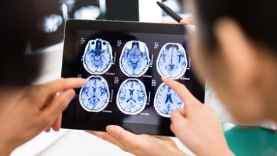 New Breakthroughs in Alzheimer’s Treatment: What the Research Says