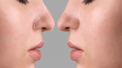 Nose Job